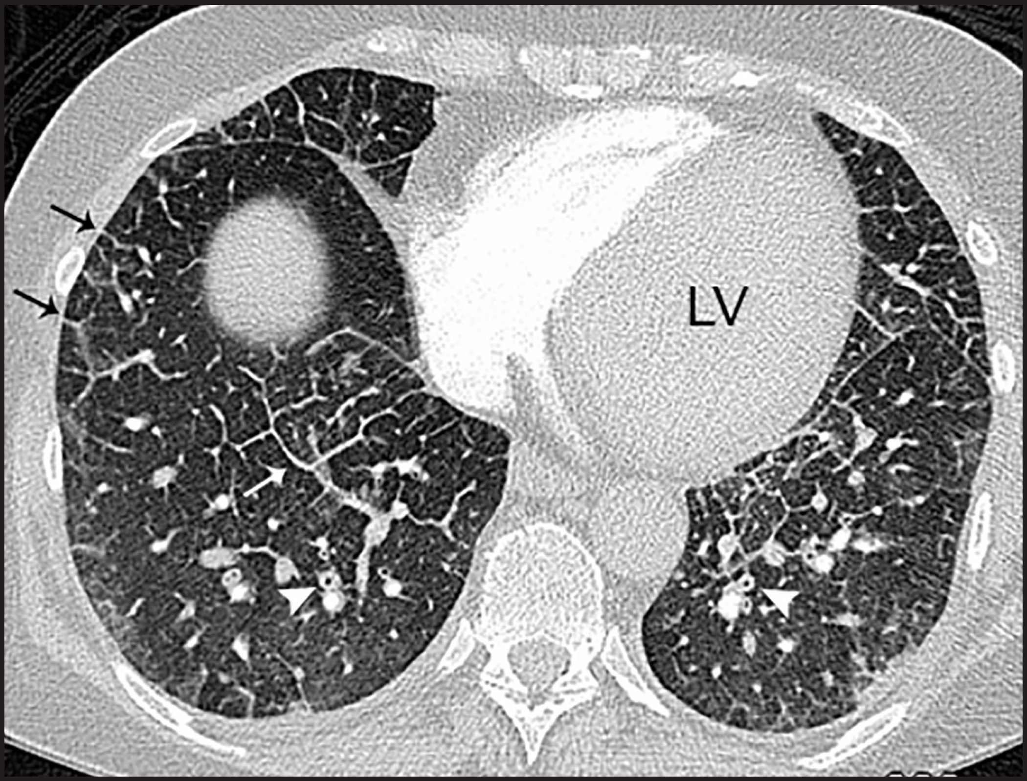 FIGURE 4.