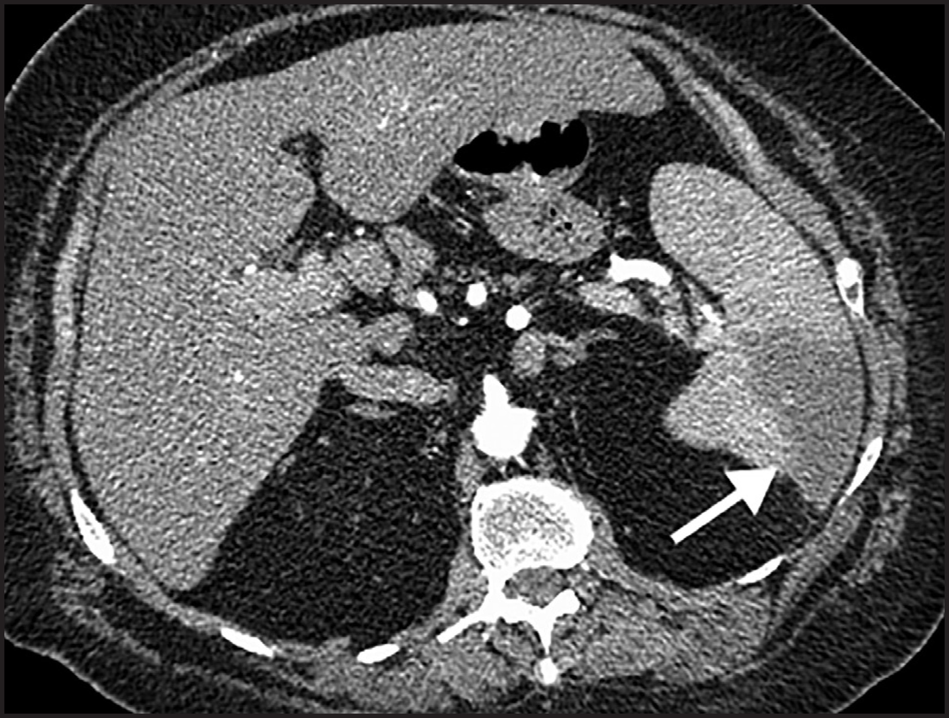 FIGURE 11.