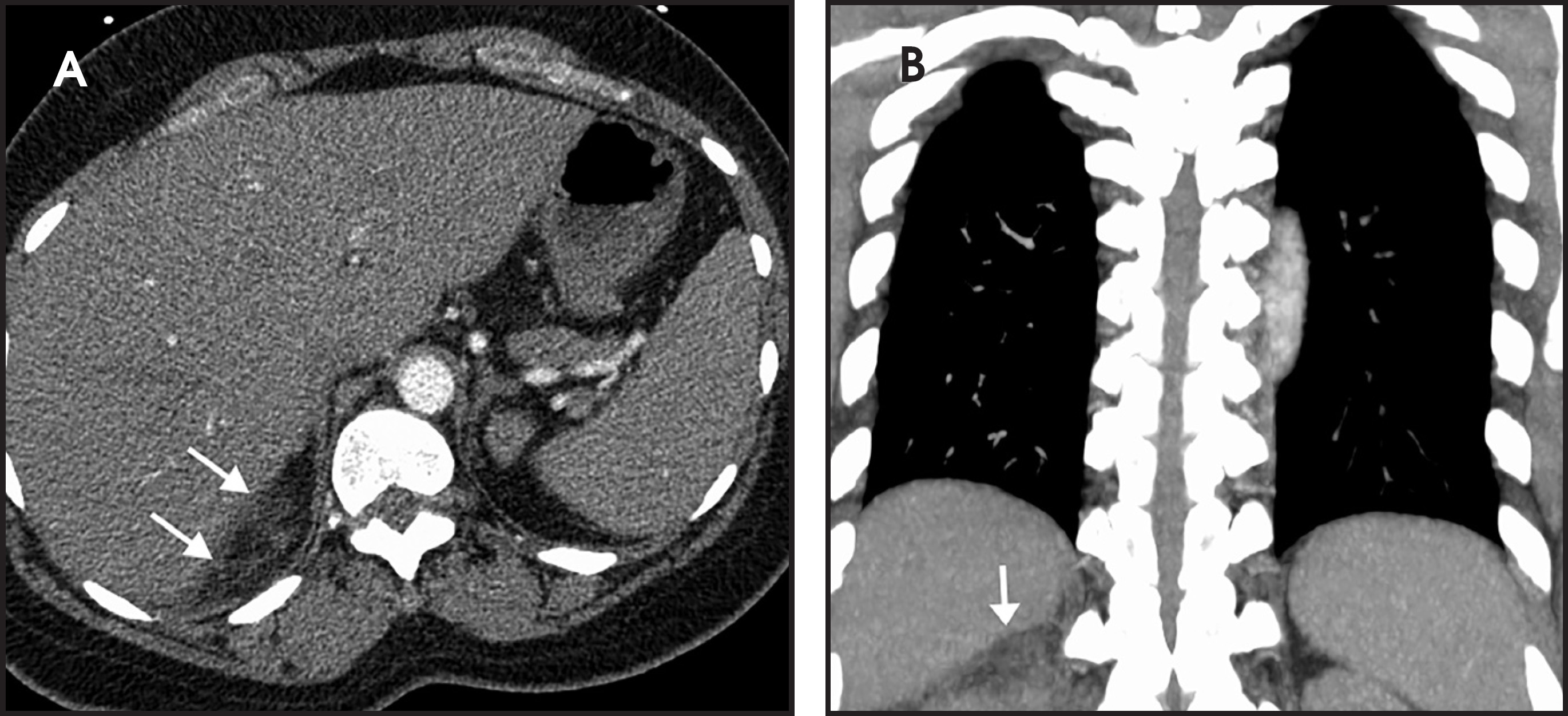 FIGURE 12.