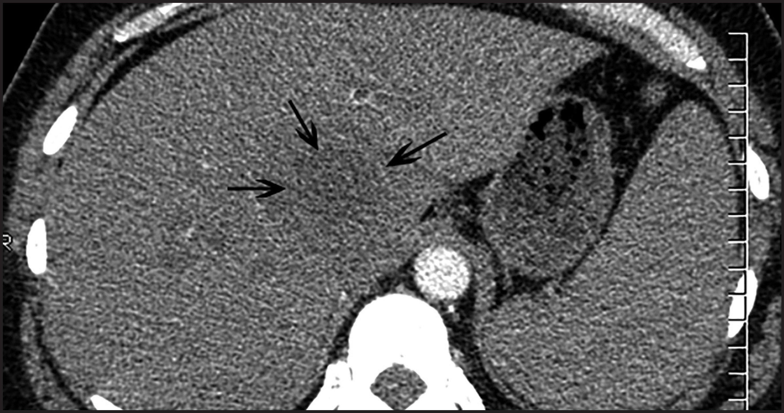 FIGURE 13.