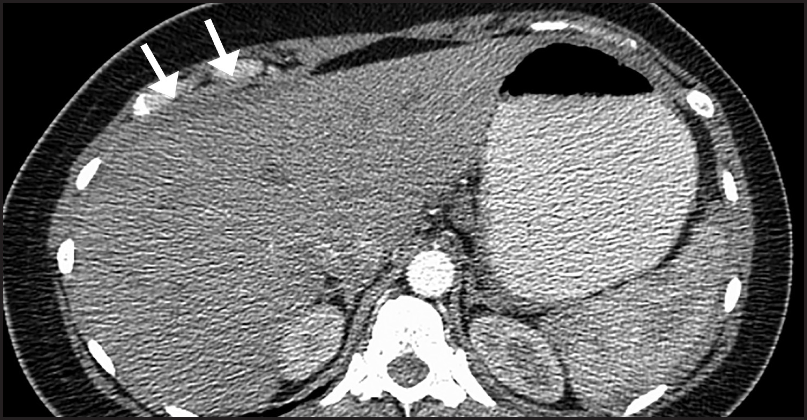 FIGURE 14.