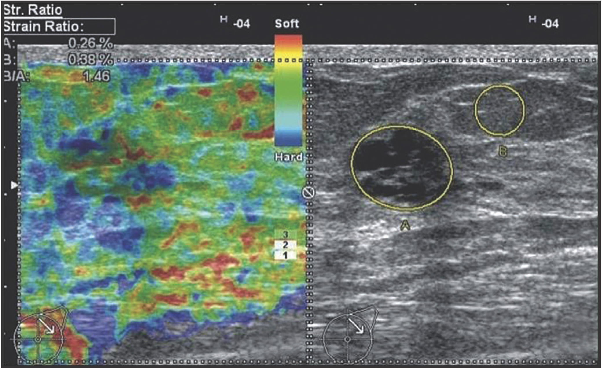 FIGURE 4.