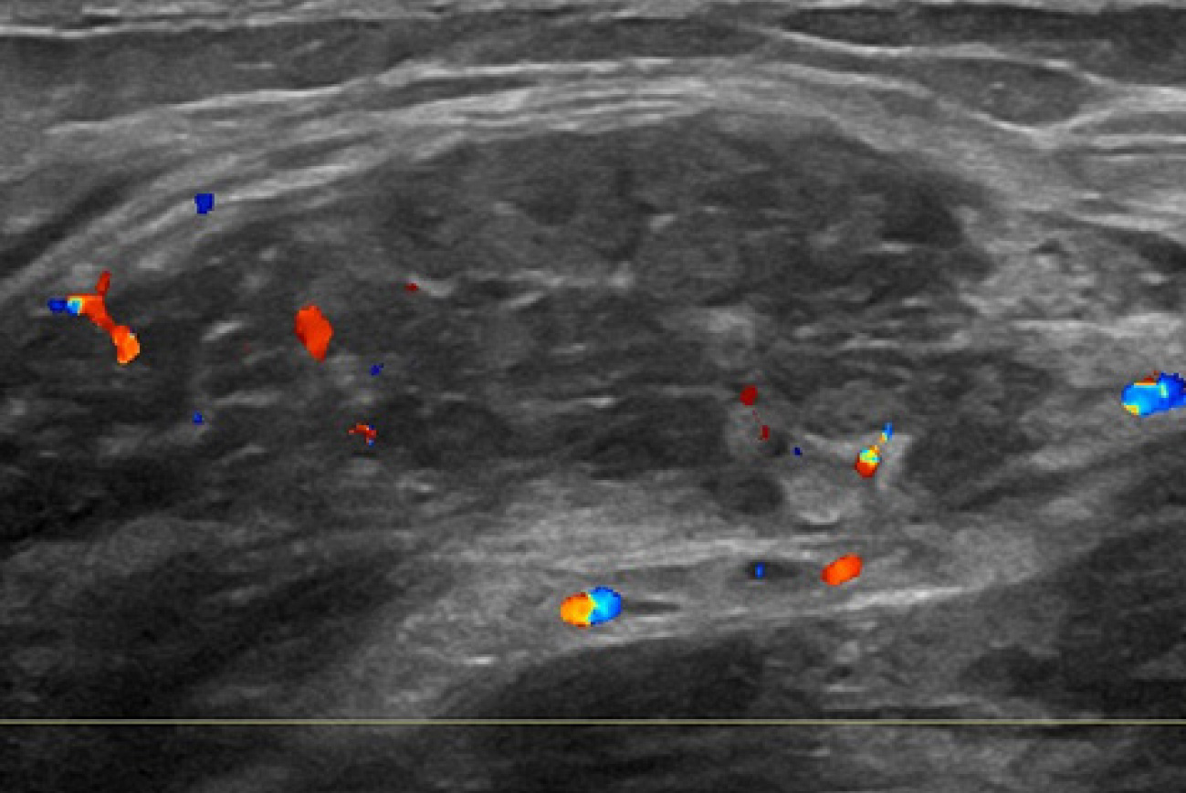 FIGURE 2.