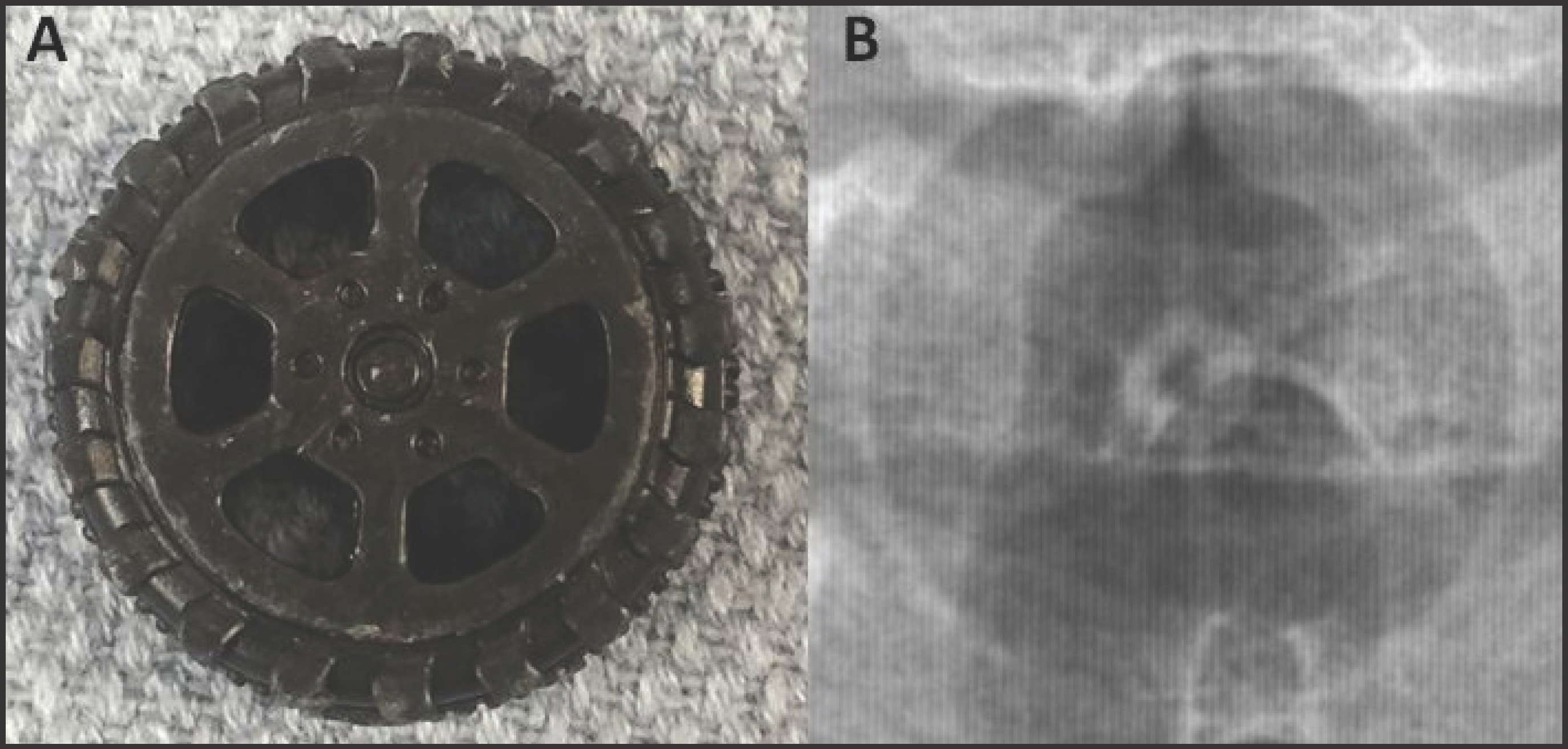 FIGURE 3.