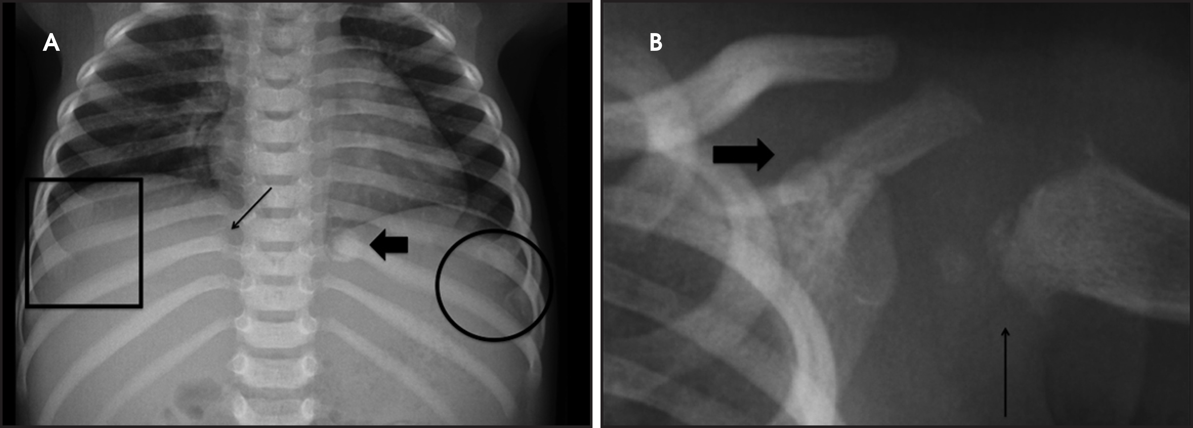 FIGURE 11.