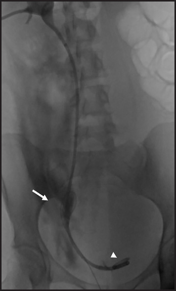 FIGURE 3.