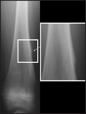 FIGURE 9.