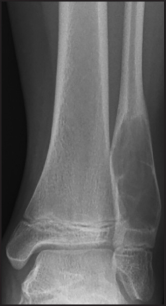 FIGURE 11.