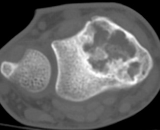 FIGURE 13.