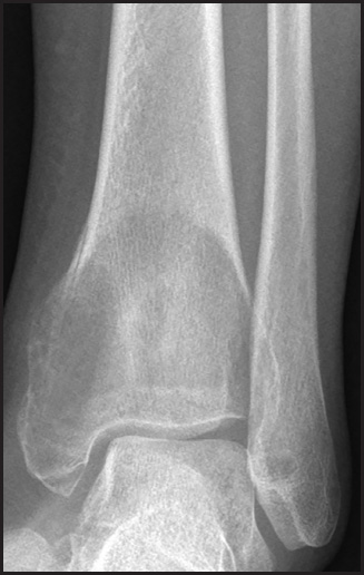FIGURE 16.