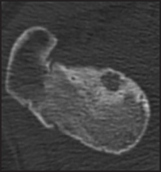 FIGURE 17.