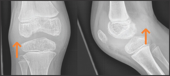 FIGURE 4.
