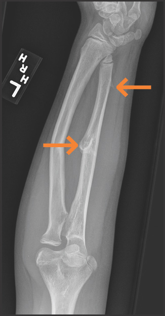FIGURE 11.