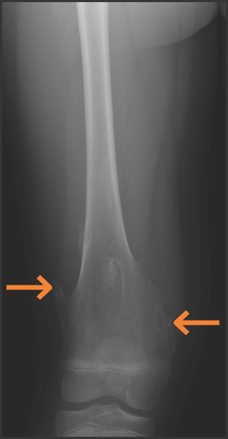 FIGURE 12.