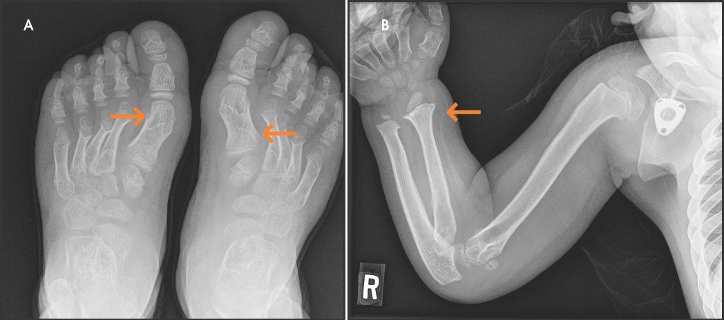 FIGURE 13.