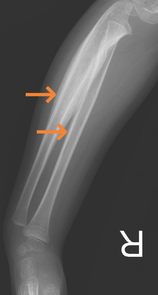 FIGURE 14.