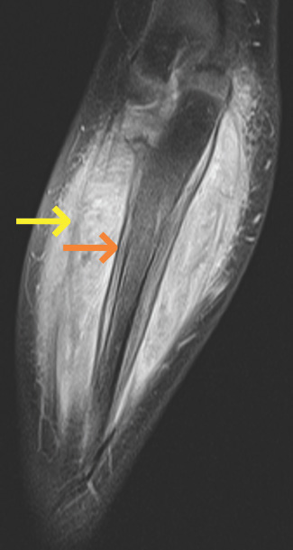 FIGURE 15.