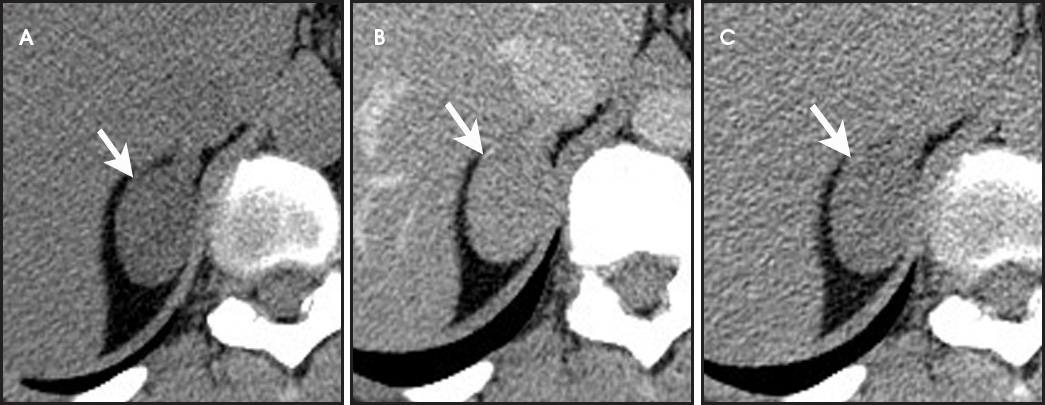 FIGURE 5.