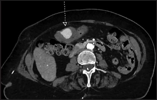 FIGURE 1.