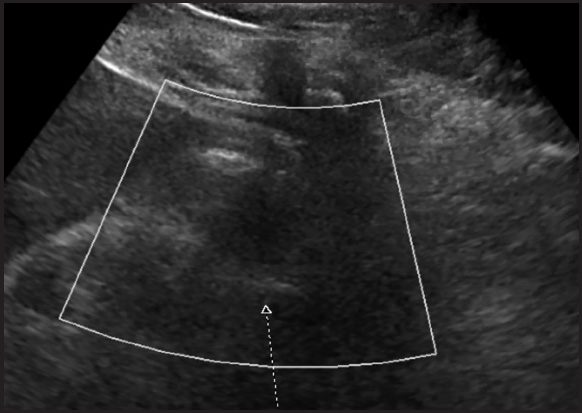 FIGURE 4.