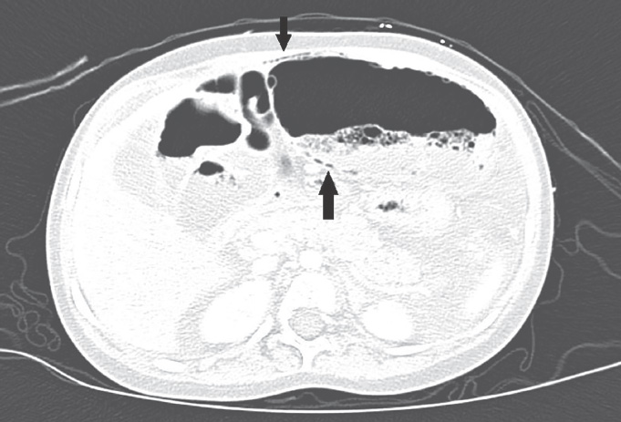 FIGURE 4.