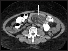 FIGURE 10.