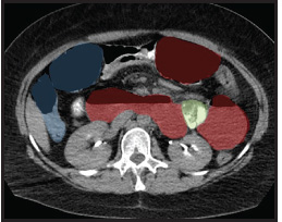 FIGURE 11.