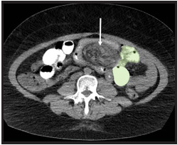 FIGURE 12.