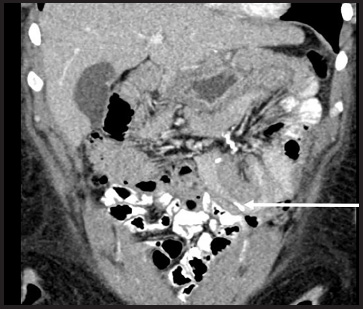 FIGURE 13.