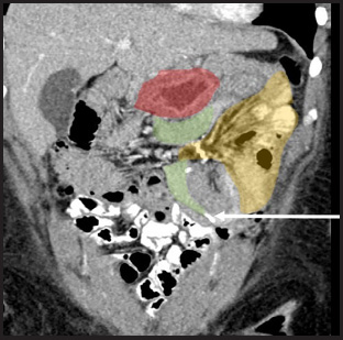 FIGURE 14.
