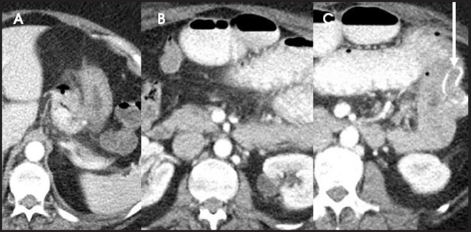 FIGURE 15.
