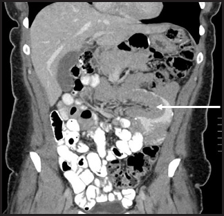 FIGURE 16.