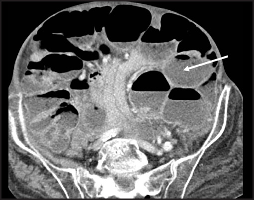 FIGURE 17.