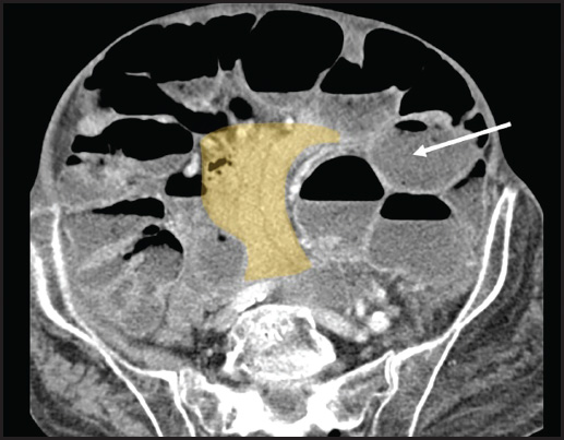 FIGURE 18.