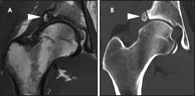 FIGURE 3.