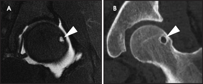 FIGURE 6.