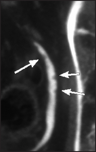 FIGURE 9.