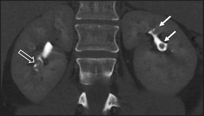 FIGURE 11.