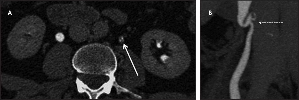 FIGURE 12.