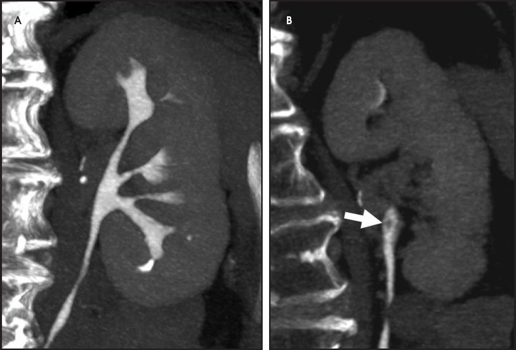 FIGURE 13.