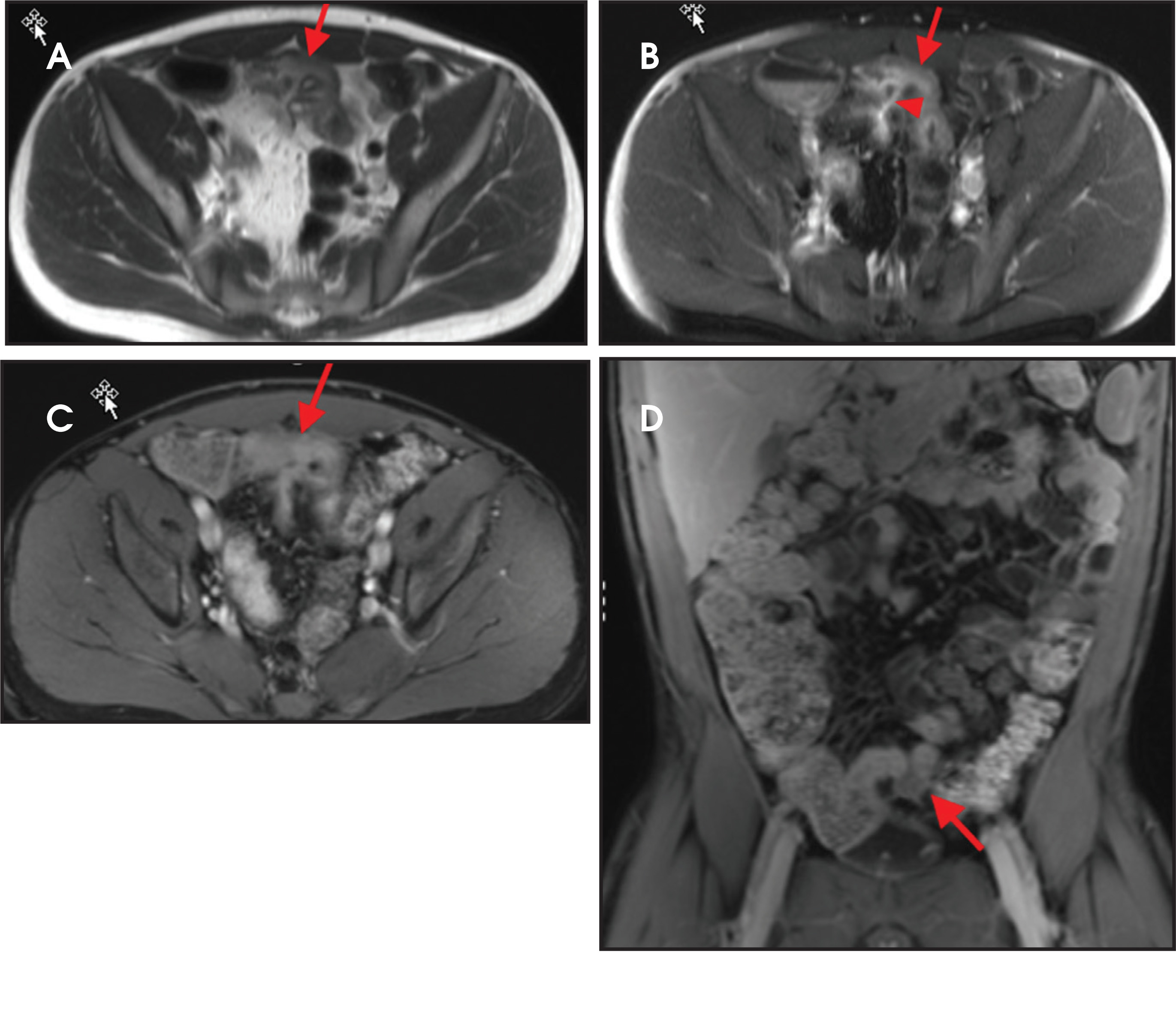 FIGURE 2.