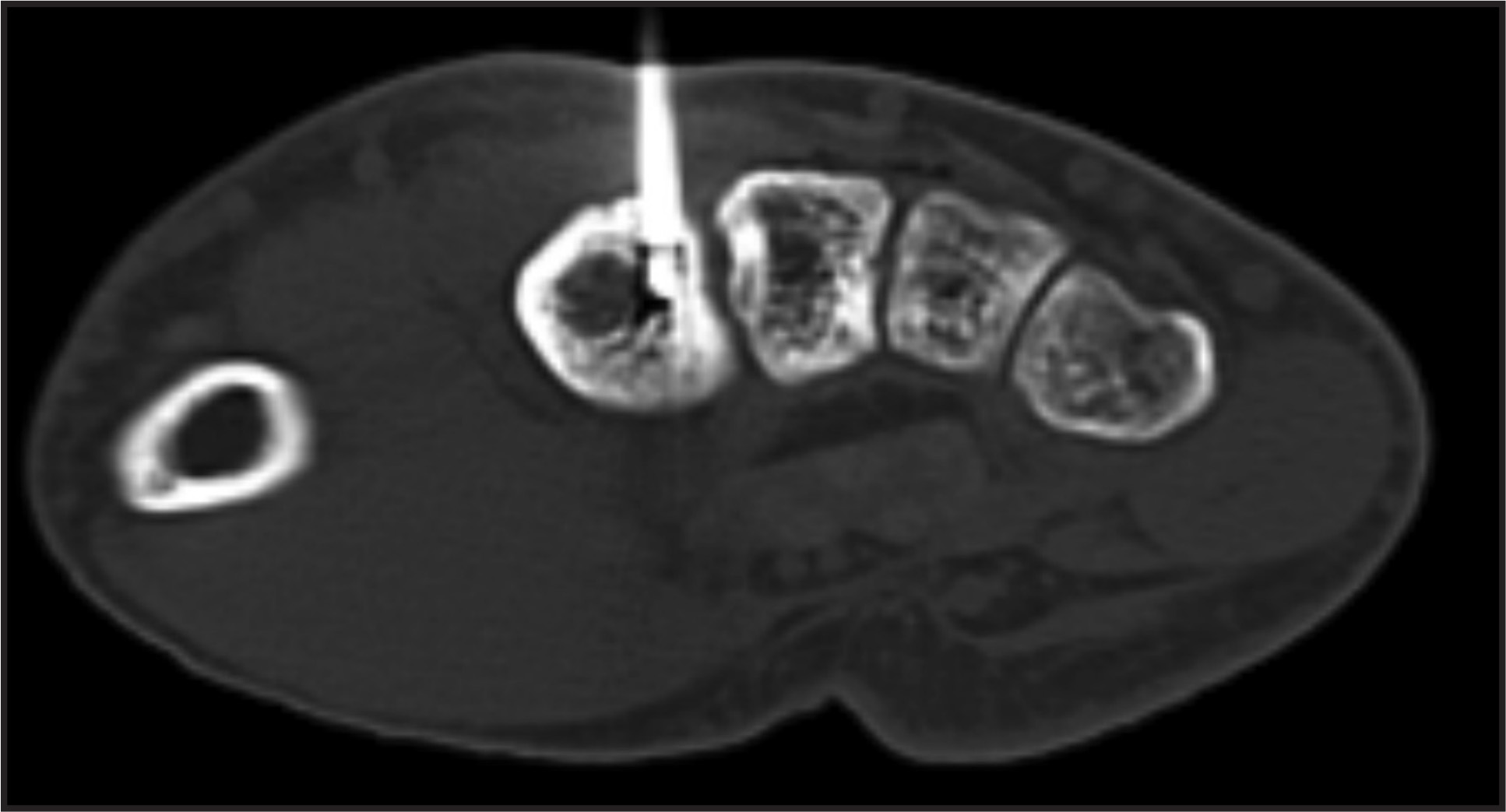 FIGURE 4.