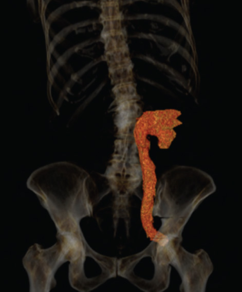 FIGURE 3.