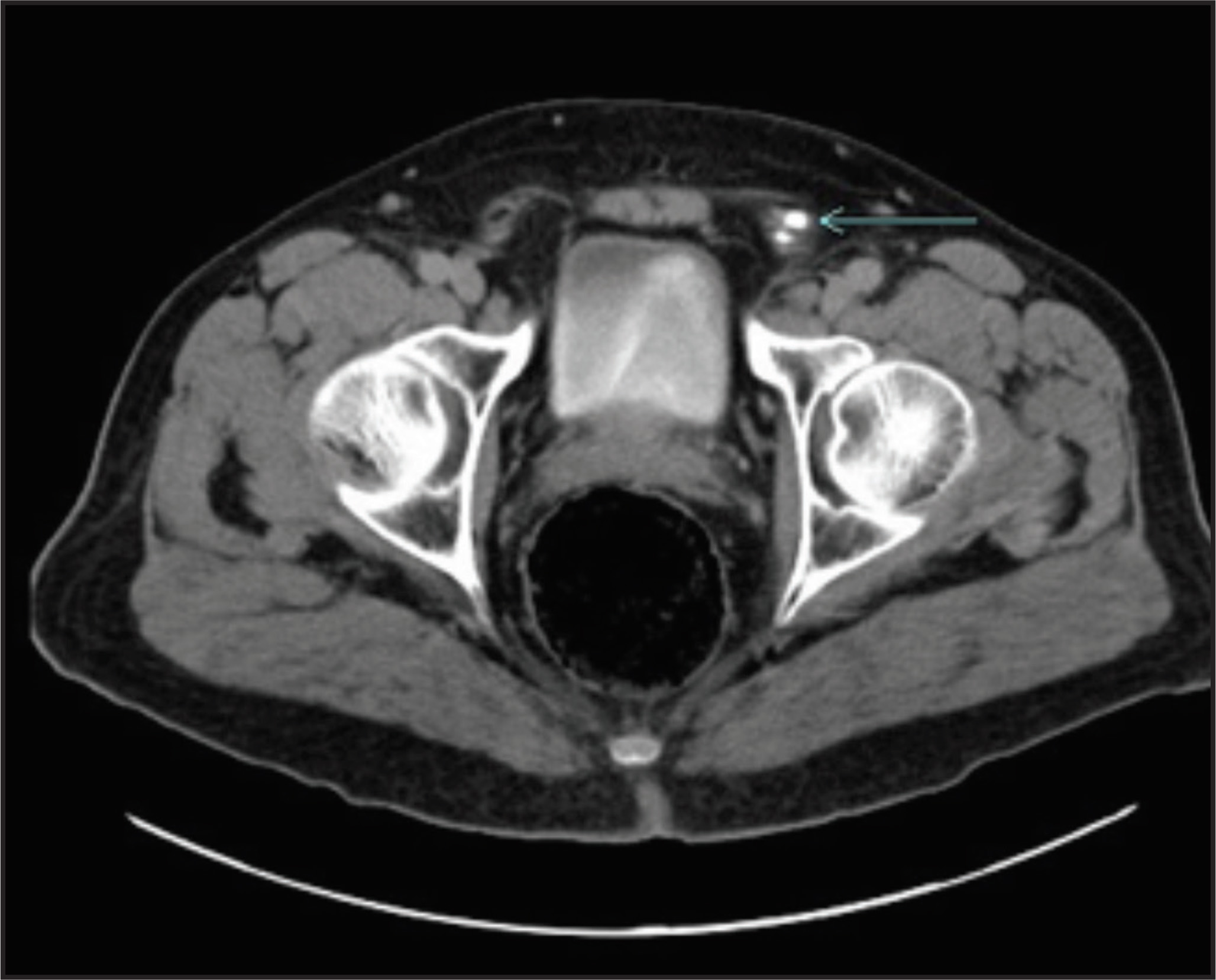 FIGURE 2.