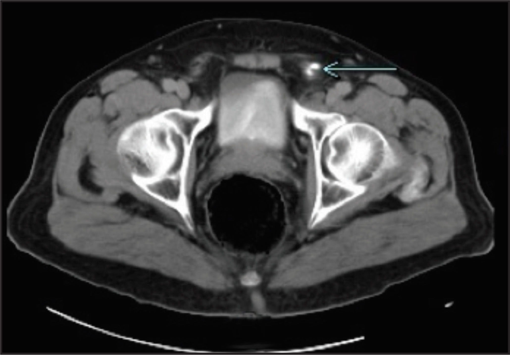 FIGURE 3.