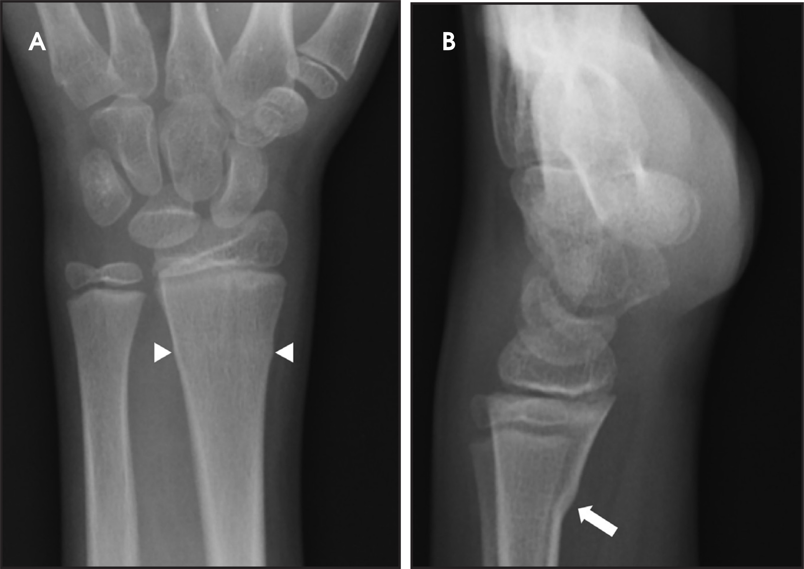 FIGURE 3.