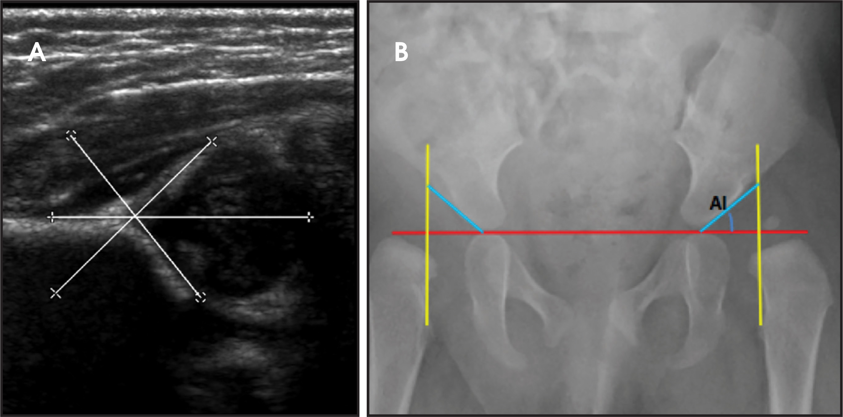 FIGURE 4.