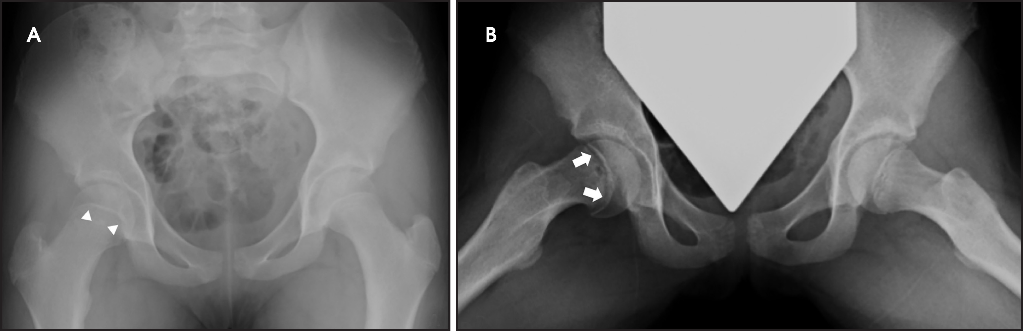 FIGURE 6.