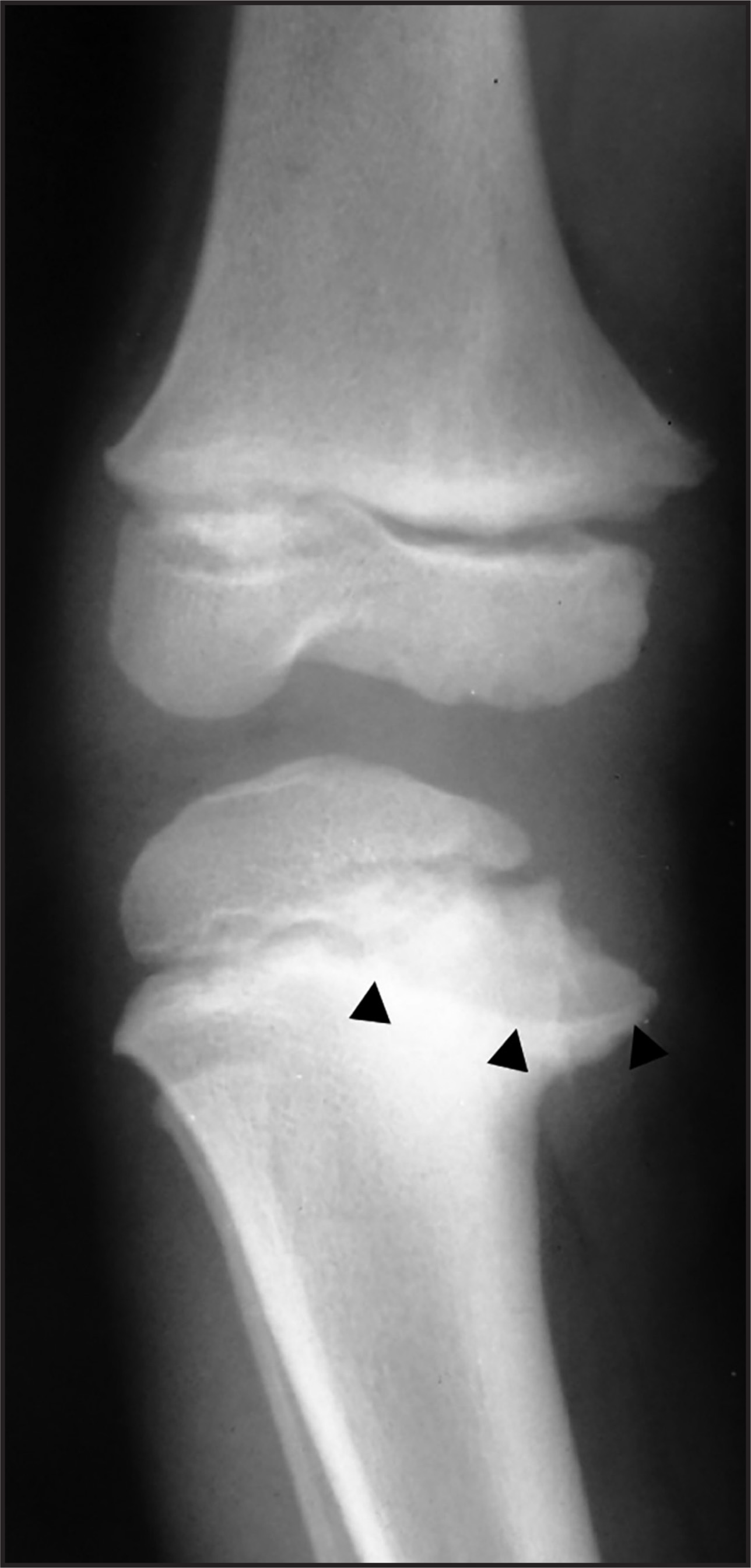 FIGURE 11.