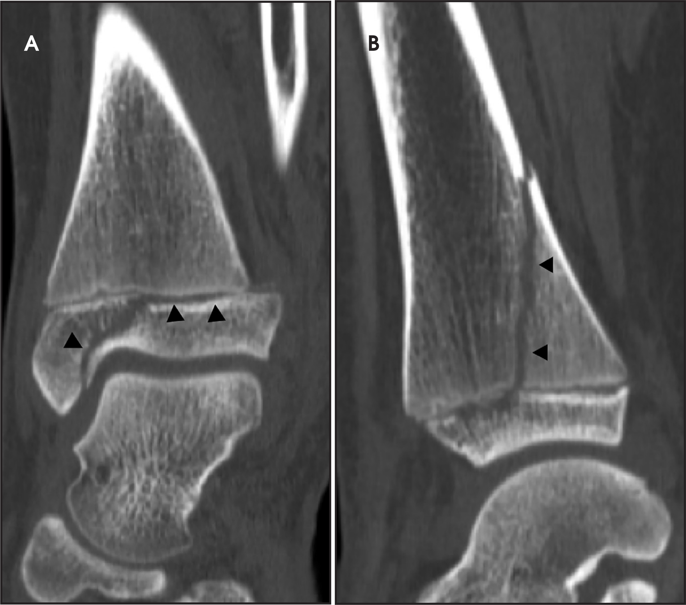 FIGURE 12.